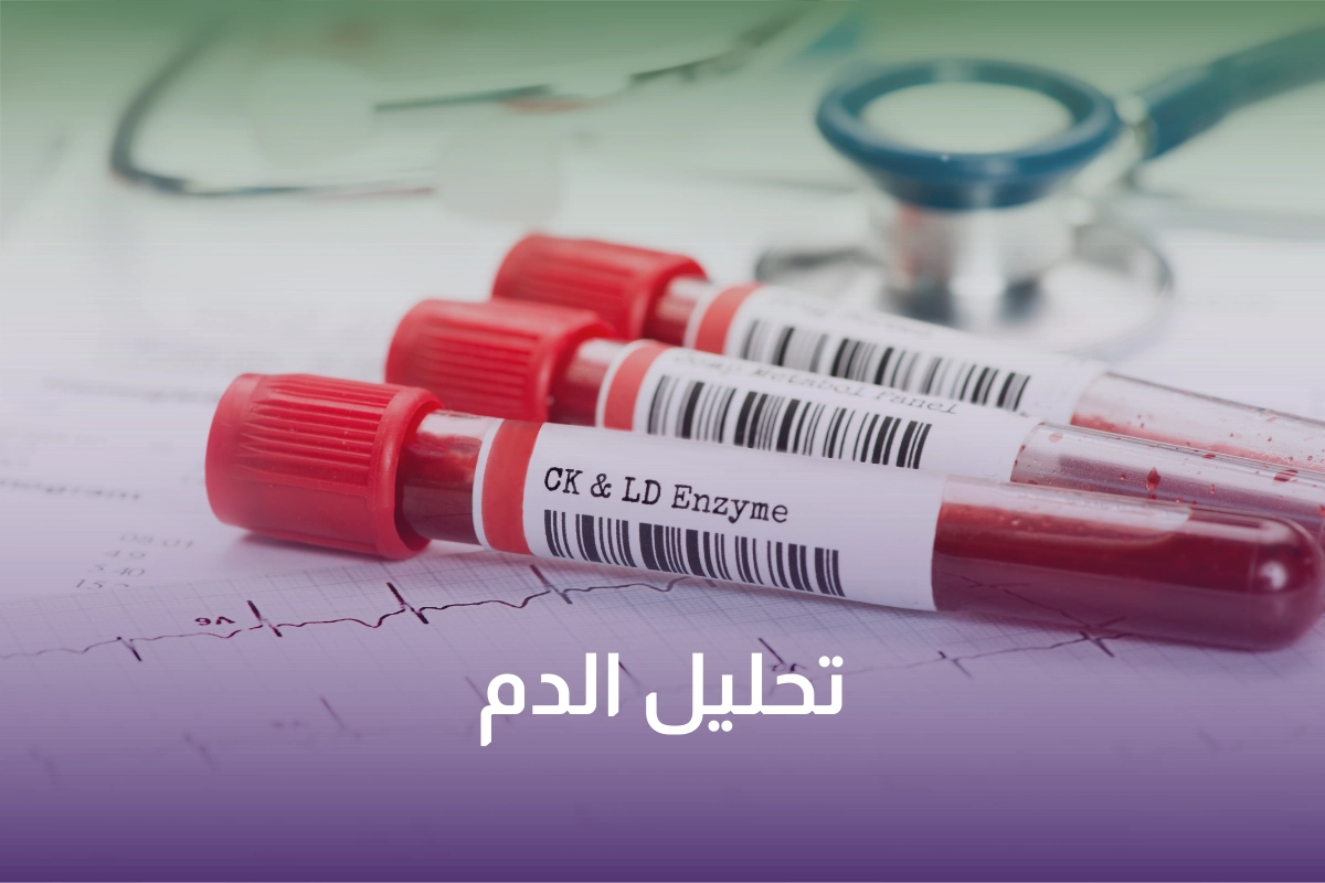 تحليل السكر التراكمي والدم